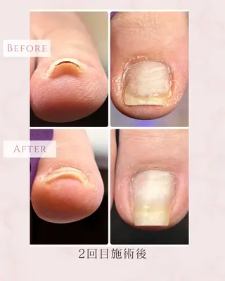 ネイル N.style所属・Ｎ. styleのネイルデザイン