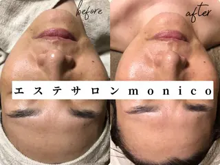 エステサロン monicoの眉毛・アイブロウイメージ