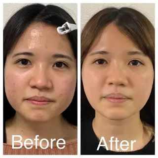 医療提携サロン新宿 La Lunaのエステ・リラクイメージ