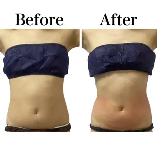 Beauty SalonEclatのエステ・リラクイメージ