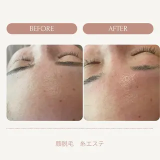 肌荒れに悩む方のため オイルフリーサロンのマツエク・マツパデザイン