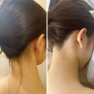 うなじ脱毛/美肌脱毛 LABELのエステ・リラクイメージ