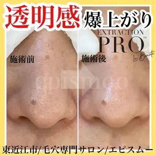 epismoo 脱毛/HBL/毛穴の眉毛・アイブロウイメージ