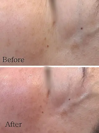 Hisui 種村のエステ・リラクイメージ