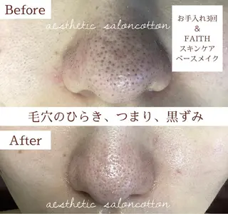 都度払い 肌質改善専門サロンのエステ・リラクイメージ