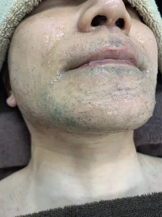 脱毛サロン BRIDGE橋本のエステ・リラクイメージ