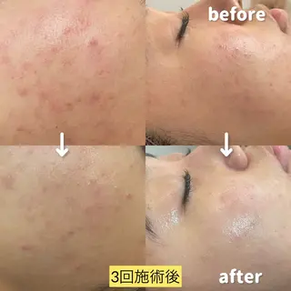 【PourVous】 AYUMIのネイルデザイン