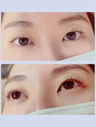 マツエク・マツパ E'clat所属・E'clat Kanaのエステ・リラクイメージ