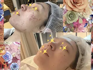 光エステ シエルのエステ・リラクイメージ