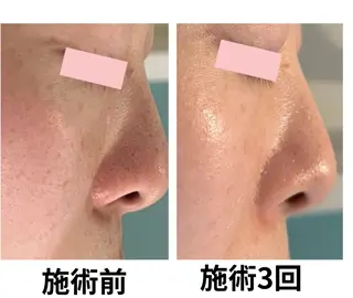 フェイシャルエステサロン 　グレースティー所属・毛穴・ニキビ専門 エステグレースティーのエステ・リラクイメージ