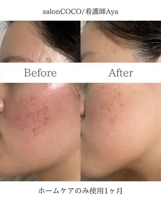 salonCOCO所属・肌管理看護師💎 salonCOCOのエステ・リラクイメージ