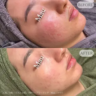 Mau beauty salon所属・Mau (マウ)のエステ・リラクイメージ