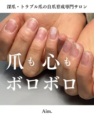 ネイル Aim* 深爪・自爪育成専門店のネイルデザイン
