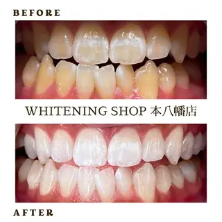 メンズ ホワイトニング ショップ本八幡店のエステ・リラクイメージ