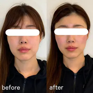 小顔矯正&美容整体 整え屋REDオーナーのエステ・リラクイメージ