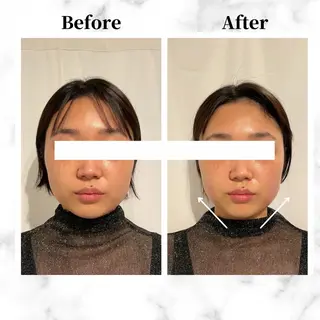 12Dハイフ💗 最強小顔のエステ・リラクイメージ