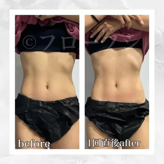 部分痩せ♥️小顔専門 MIKUのエステ・リラクイメージ