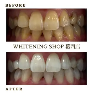 メンズ ホワイトニング ショップ葛西店のその他イメージ