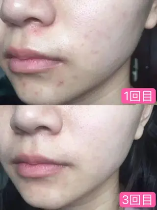 Nature Souce毛穴専門店のその他イメージ