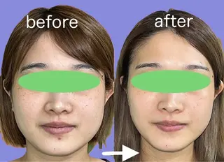 春日井トータルからだ サロンふくふくのエステ・リラクイメージ