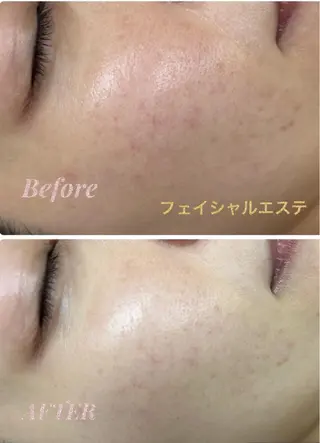 レイビス 函館店のエステ・リラクイメージ