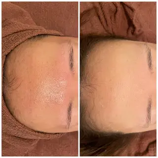 セミロング カラー パーマ ヘアアレンジ メンズ キッズ ネイル マツエク・マツパ アイブロウ ニキビ特化型エステ 🍓最短で肌質改善のエステ・リラクイメージ