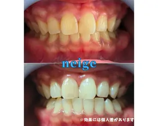 ホワイトニングサロン ネージュ(女性専用)のその他イメージ