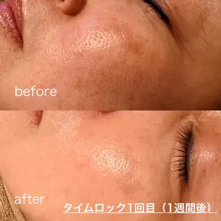 渡韓不要🇰🇷韓国 美肌管理＆眉のエステ・リラクイメージ