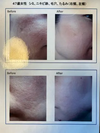 井上 裕子のエステ・リラクイメージ