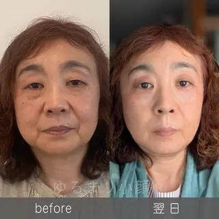 小顔矯正サロン町田 逸見智美のエステ・リラクイメージ