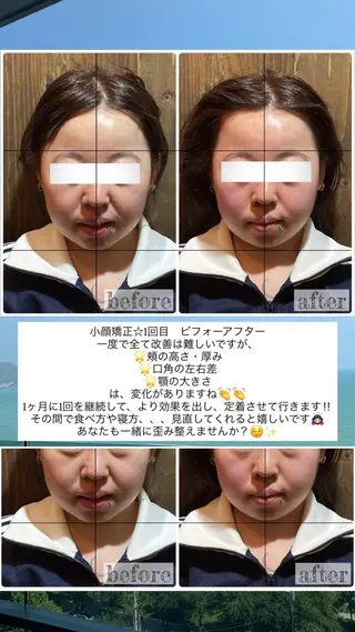 💎後悔させない小顔 矯正💎イトヤマ🌱のエステ・リラクイメージ