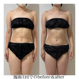 Rutio所属・Rutio 筋膜リリースのエステ・リラクイメージ