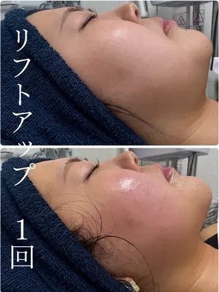 THE  PEACH スタッフのエステ・リラクイメージ