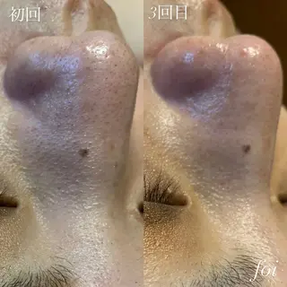 艶肌デトックス🫧 Samiraのエステ・リラクイメージ