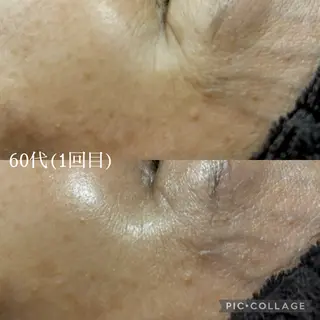 メンズ BeautySalon　heart所属・Beauty Salonheartのエステ・リラクイメージ