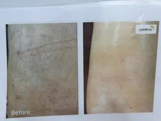 韓国肌管理専門店 Clear Lab 池袋所属・韓国肌管理専門店 池袋店REIKAのエステ・リラクイメージ