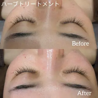 ﾌｪｲｼｬﾙｴｽﾃ ﾗﾄｩｰﾙ伊深のエステ・リラクイメージ