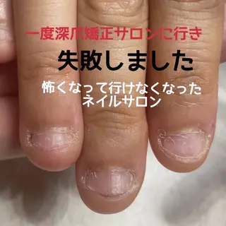 ネイル 一之瀬 柚季のネイルデザイン