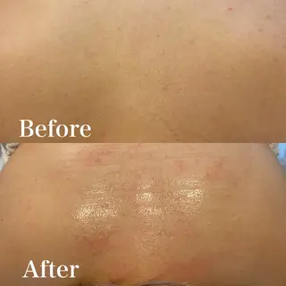 wax脱毛専門店 ハイラントのエステ・リラクイメージ