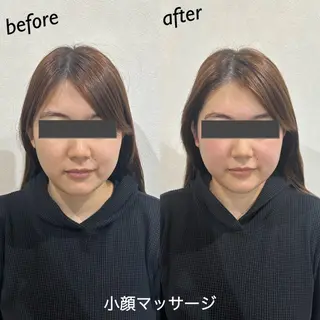 うなじ脱毛/美肌脱毛 LABELのエステ・リラクイメージ