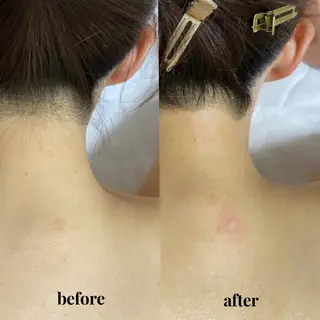 シュガーリング 【MARLS】の眉毛・アイブロウイメージ