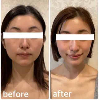 小顔コルギ＆オイル アンドエスのエステ・リラクイメージ