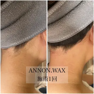 肌質改善ワックス専門 yukiのエステ・リラクイメージ