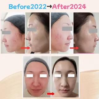 上尾Luce. あきやまのエステ・リラクイメージ