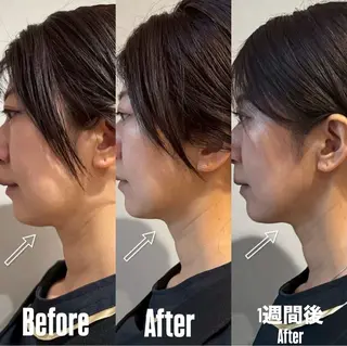 六本木脱毛andS さおりのエステ・リラクイメージ