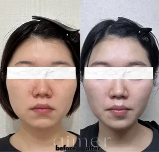 aimer 島田のエステ・リラクイメージ