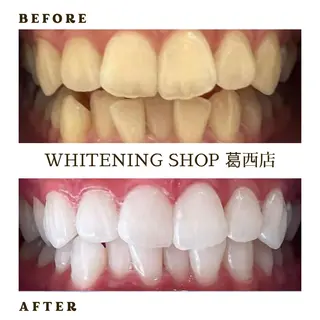 メンズ ホワイトニング ショップ葛西店のその他イメージ