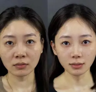 aliaハイフ&水光ジェットサロン所属・aliaハーブ水光店 エステティシャン募集のエステ・リラクイメージ