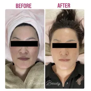 プラティーヌ ボーテ【もものり】のその他イメージ