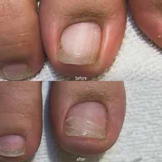 ネイル 𝗿𝗶𝗰𝗼 ˎˊ˗のネイルデザイン